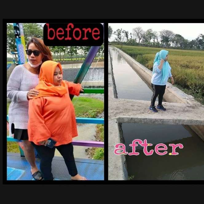Potret Transformasi Kekeyi Sebelum dan Sesudah Diet, Pipi Tirusnya Jadi Sorotan!