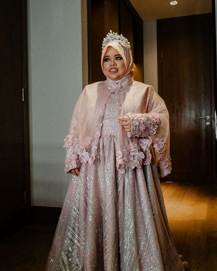 Potret Transformasi Kekeyi Sebelum dan Sesudah Diet, Pipi Tirusnya Jadi Sorotan!
