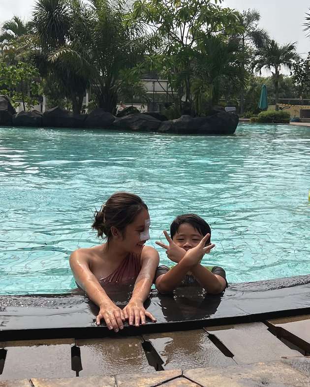 Potret Gaya Permesta Dhyaz Anak Farida Nurhan, Pernah Oplas di Thailand Hingga Hidungnya Alami Infeksi!