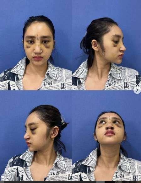 Potret Gaya Permesta Dhyaz Anak Farida Nurhan, Pernah Oplas di Thailand Hingga Hidungnya Alami Infeksi!