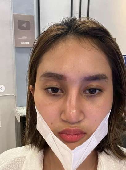 Potret Gaya Permesta Dhyaz Anak Farida Nurhan, Pernah Oplas di Thailand Hingga Hidungnya Alami Infeksi!