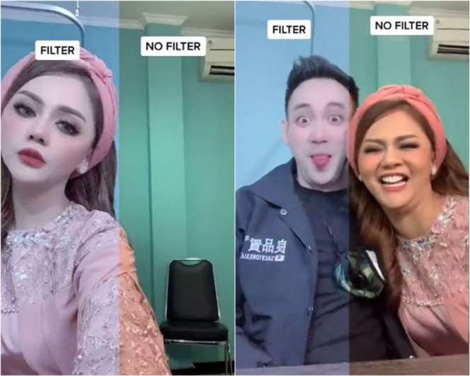 Potret 8 Seleb Sebelum dan Sesudah Pakai Filter, Aurel Hermansyah Bikin Melongo!