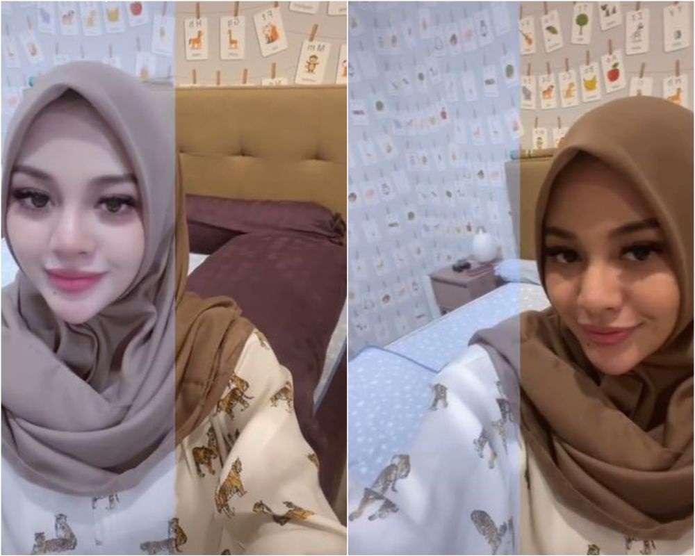 Potret 8 Seleb Sebelum dan Sesudah Pakai Filter, Aurel Hermansyah Bikin Melongo!