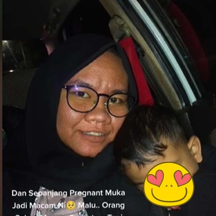 Potret Wanita yang Hamil Alami Kondisi Aneh, Wajah Bengkak dan Keriput Mirip Nenek-Nenek