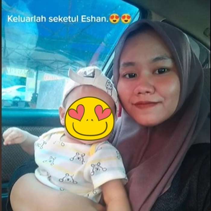 Potret Wanita yang Hamil Alami Kondisi Aneh, Wajah Bengkak dan Keriput Mirip Nenek-Nenek