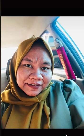 Potret Wanita yang Hamil Alami Kondisi Aneh, Wajah Bengkak dan Keriput Mirip Nenek-Nenek