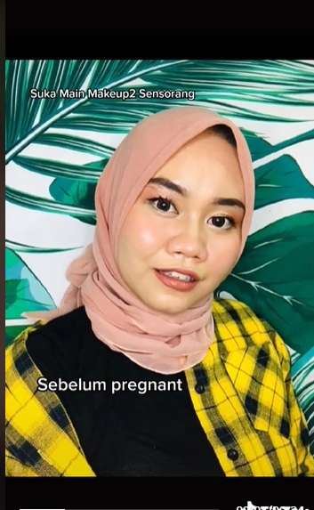 Potret Wanita yang Hamil Alami Kondisi Aneh, Wajah Bengkak dan Keriput Mirip Nenek-Nenek