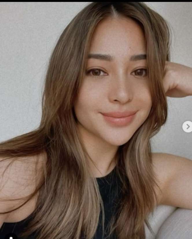 8 Seleb Cantik yang Lakukan Suntik Botox, Paras Maia Estianty Ramai Tuai Sorotan!