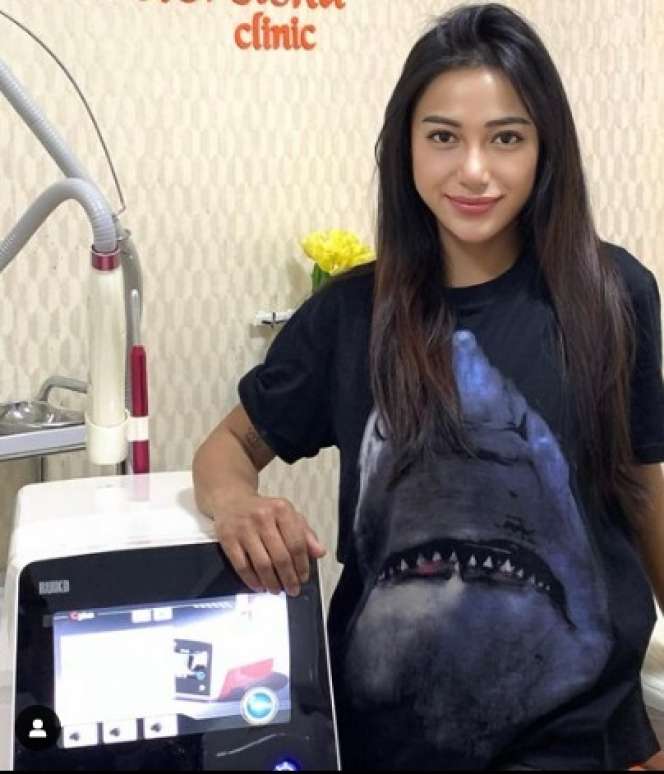 Potret Rezy Adisty Model Cantik yang Kerap Berbagi dengan Anak-anak Manusia Silver, Sisi Lain yang Tak Banyak Orang Tahu!