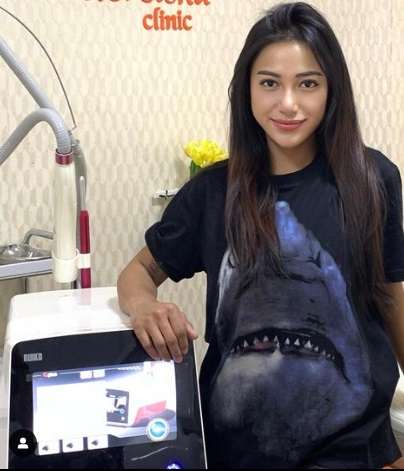 Potret Rezy Adisty Model Cantik yang Kerap Berbagi dengan Anak-anak Manusia Silver, Sisi Lain yang Tak Banyak Orang Tahu!