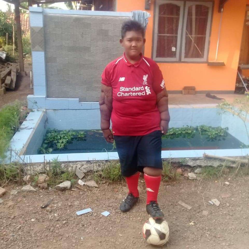 10 Potret Rumah Arya Permana, Bocah Obesitas Viral Dulu 192 Kg, Kini Jadi Gagah & Ganteng!