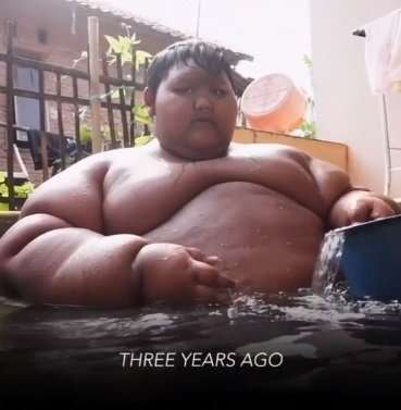 10 Potret Rumah Arya Permana, Bocah Obesitas Viral Dulu 192 Kg, Kini Jadi Gagah & Ganteng!