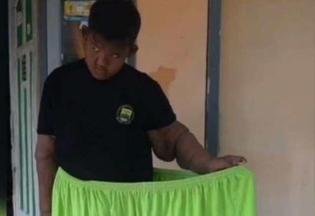 10 Potret Rumah Arya Permana, Bocah Obesitas Viral Dulu 192 Kg, Kini Jadi Gagah & Ganteng!