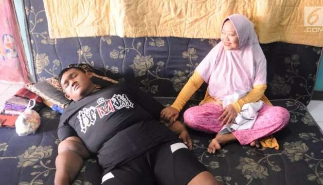 10 Potret Rumah Arya Permana, Bocah Obesitas Viral Dulu 192 Kg, Kini Jadi Gagah & Ganteng!