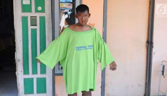 10 Potret Rumah Arya Permana, Bocah Obesitas Viral Dulu 192 Kg, Kini Jadi Gagah & Ganteng!