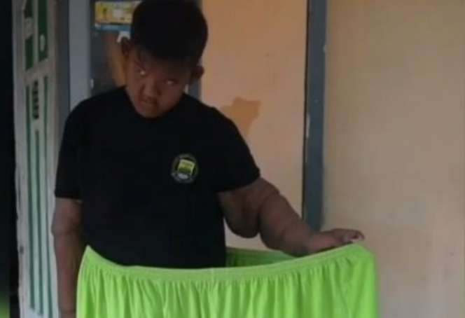 10 Potret Rumah Arya Permana, Bocah Obesitas Viral Dulu 192 Kg, Kini Jadi Gagah & Ganteng!