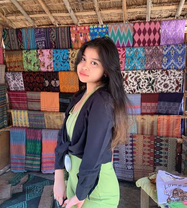 Potret Sarah Suci Anak Ruhut Sitompul yang Jarang Tersorot, Ternyata Punya Segudang Prestasi!