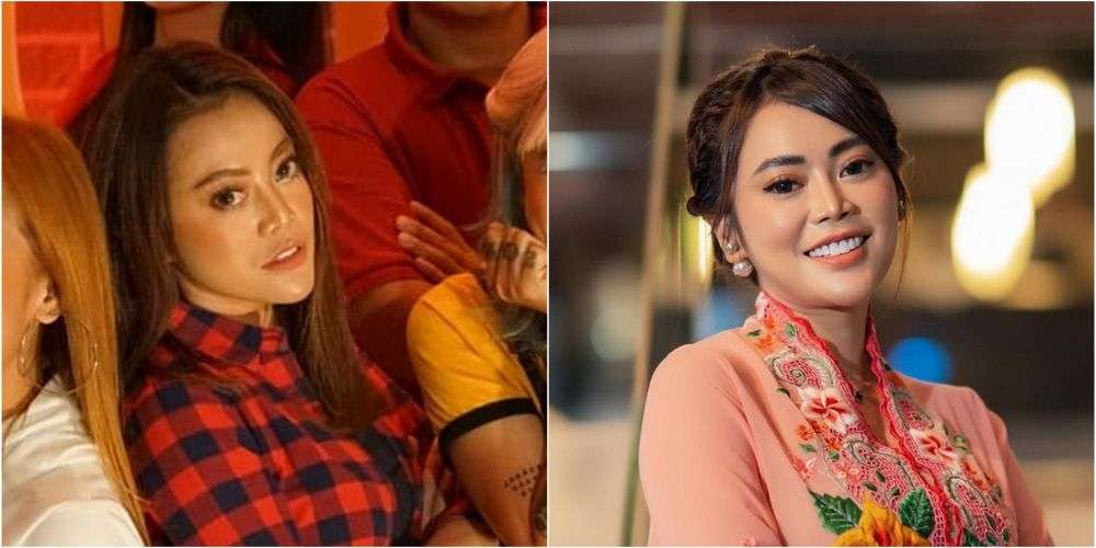 Potret Dulu VS Sekarang Daniar Masterchef Indonesia, Jalani Operasi Hidung Hasilnya Bikin Penasaran!