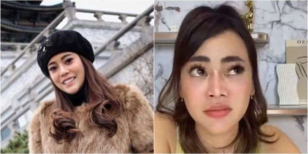 Potret Dulu VS Sekarang Daniar Masterchef Indonesia, Jalani Operasi Hidung Hasilnya Bikin Penasaran!