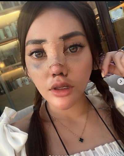 Potret Dulu VS Sekarang Daniar Masterchef Indonesia, Jalani Operasi Hidung Hasilnya Bikin Penasaran!