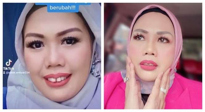Potret Dulu dan Sekarang Elly Sugigi, Sempat Diduga Oplas Kini Penampilannya Bikin Pangling!