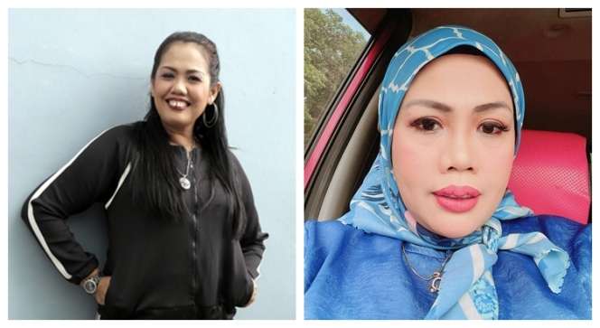 Potret Dulu dan Sekarang Elly Sugigi, Sempat Diduga Oplas Kini Penampilannya Bikin Pangling!