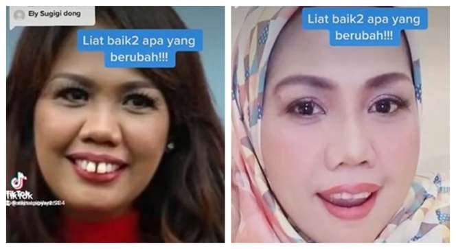 Potret Dulu dan Sekarang Elly Sugigi, Sempat Diduga Oplas Kini Penampilannya Bikin Pangling!