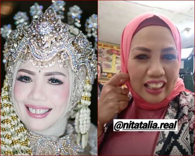 Potret Dulu dan Sekarang Elly Sugigi, Sempat Diduga Oplas Kini Penampilannya Bikin Pangling!