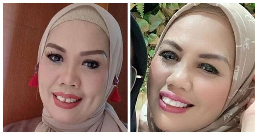 Potret Dulu dan Sekarang Elly Sugigi, Sempat Diduga Oplas Kini Penampilannya Bikin Pangling!