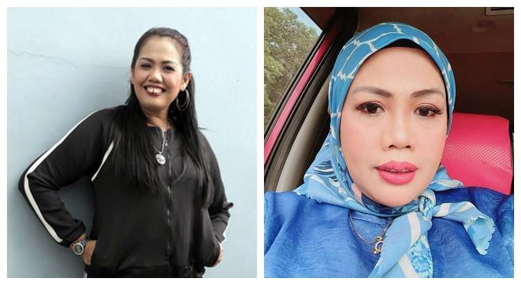 Potret Dulu dan Sekarang Elly Sugigi, Sempat Diduga Oplas Kini Penampilannya Bikin Pangling!