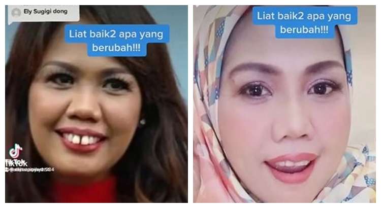 Potret Dulu dan Sekarang Elly Sugigi, Sempat Diduga Oplas Kini Penampilannya Bikin Pangling!