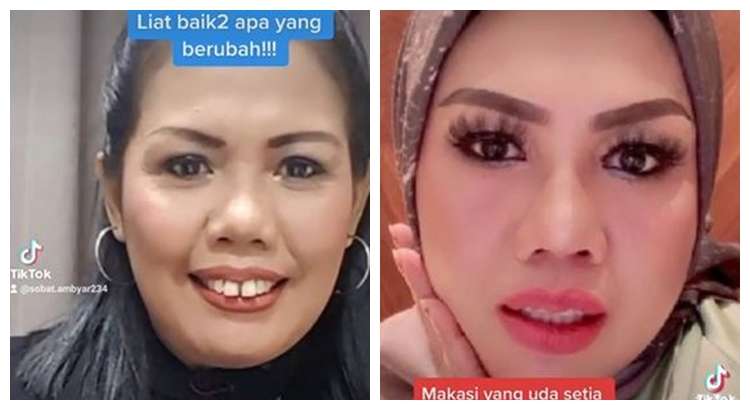 Potret Dulu dan Sekarang Elly Sugigi, Sempat Diduga Oplas Kini Penampilannya Bikin Pangling!