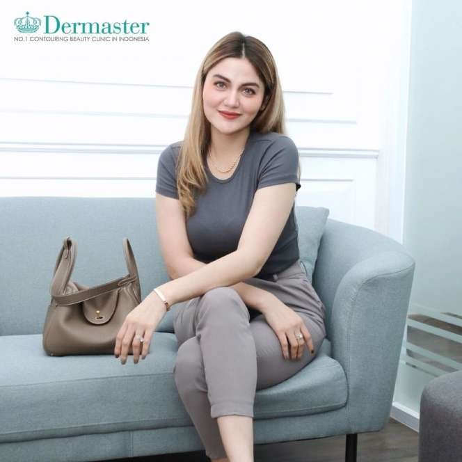 Masih Ingat Hilda Vitria Mantan Billy Syahputra? Dulu Kisah Asmaranya Bikin Heboh, Kini Kondisinya Mengejutkan!