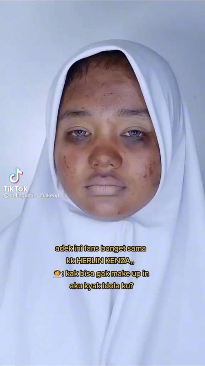 Viral Cewek Berjerawat Minta Dirias MUA Mirip Selebgram Terkenal, Hasilnya Keren Abis!