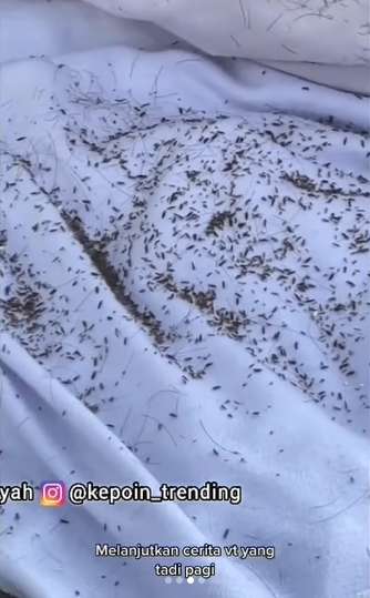 Viral Siswa SD Ngeluh Kepala Gatal, Ibu Guru Syok Saat Buka Kerudungnya, Ada Ribuan Kutu Bikin Merinding!