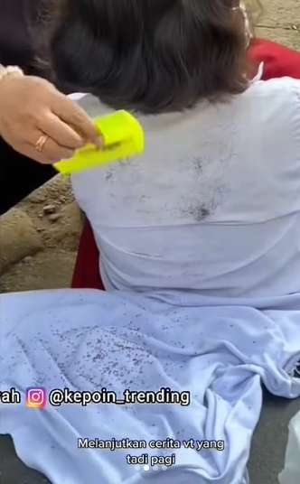 Viral Siswa SD Ngeluh Kepala Gatal, Ibu Guru Syok Saat Buka Kerudungnya, Ada Ribuan Kutu Bikin Merinding!