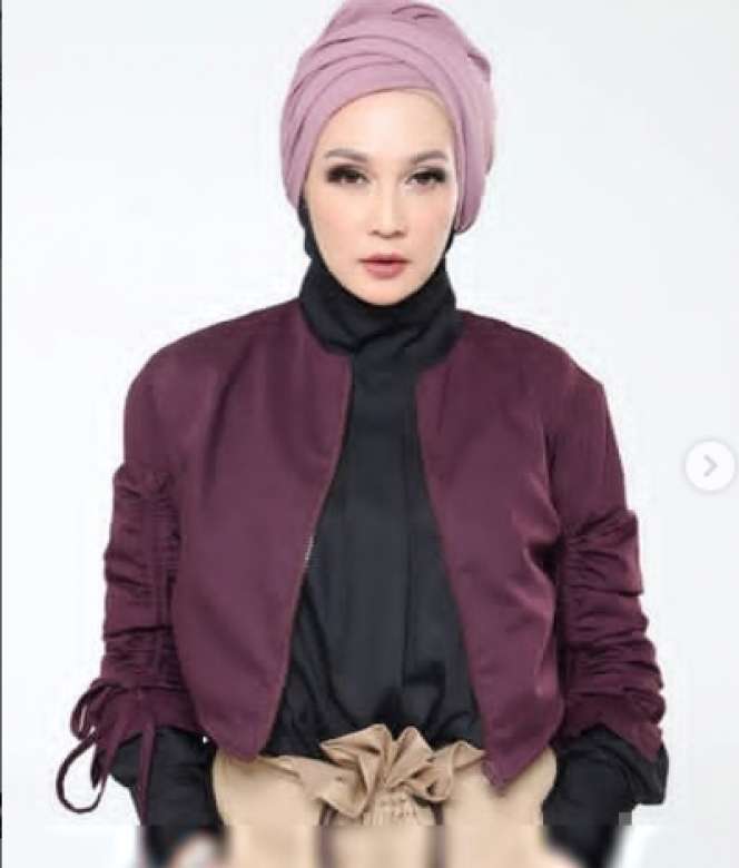 Masih Ingat Dina Lorenza? Dulu Ramai Dijodohkan dengan Ariel NOAH, Begini Kabarnya Sekarang!