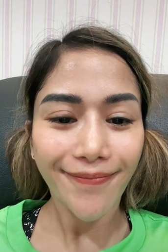 3 Kali Operasi Plastik, Bentuk Hidung Terbaru Farida Nurhan Jadi Sorotan