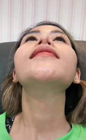 3 Kali Operasi Plastik, Bentuk Hidung Terbaru Farida Nurhan Jadi Sorotan