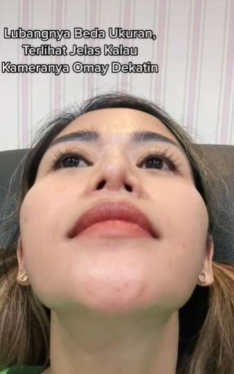 3 Kali Operasi Plastik, Bentuk Hidung Terbaru Farida Nurhan Jadi Sorotan