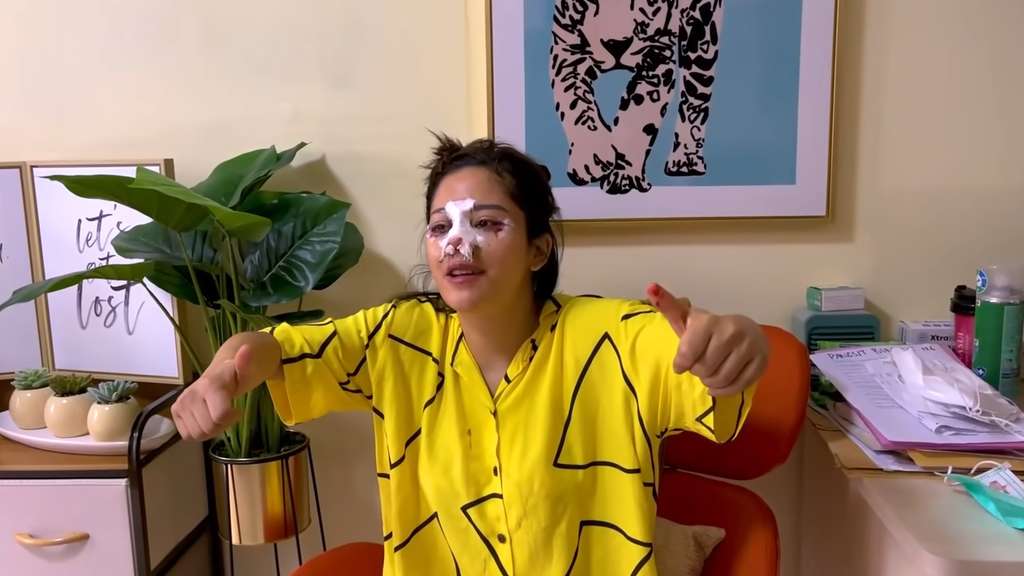 11 Transformasi Farida Nurhan Usai 3 Kali Oplas, Sampai Tak Dikenali, Disebut Mirip Michael Jackson