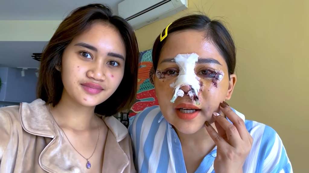 11 Transformasi Farida Nurhan Usai 3 Kali Oplas, Sampai Tak Dikenali, Disebut Mirip Michael Jackson