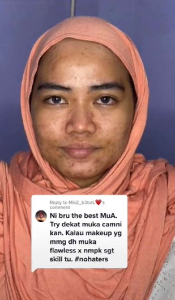 Transformasi Makeup Barbie Look Cewek Berjerawat Ini Hasilnya Bikin Melongo!