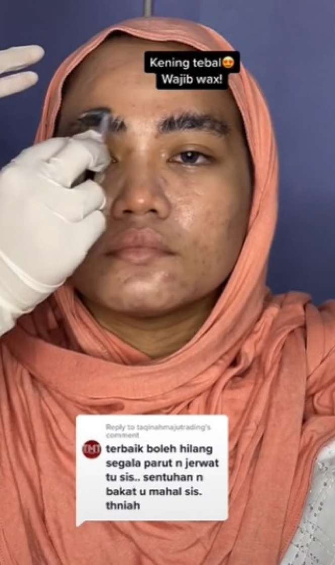Transformasi Makeup Barbie Look Cewek Berjerawat Ini Hasilnya Bikin Melongo!