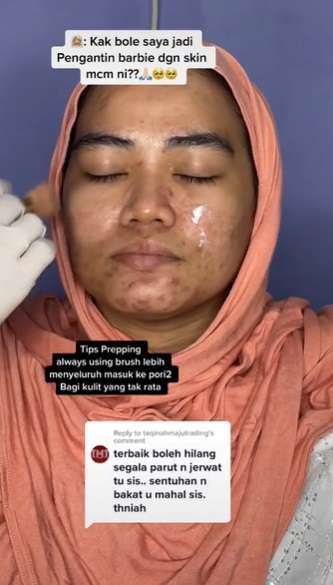 Transformasi Makeup Barbie Look Cewek Berjerawat Ini Hasilnya Bikin Melongo!