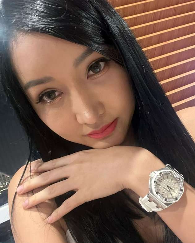 10 Potret Lucinta Luna Setelah Oplasnya Pulih Sempurna, Makin Cantik Mirip Jisoo BLACKPINK!