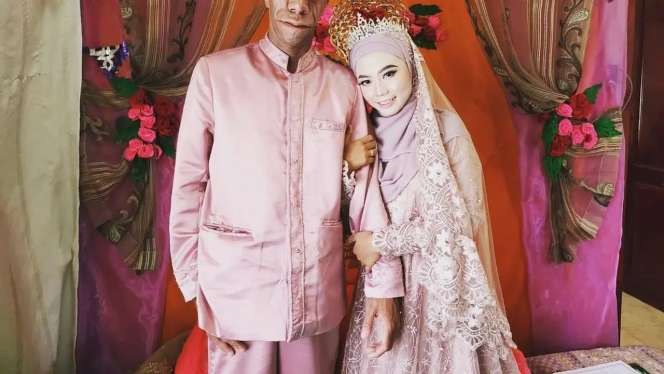 8 Potret Surya Manurung `Pengidap Sindrom Langka` Usai Nikahi Wanita Cantik, Kemesraannya Disorot!