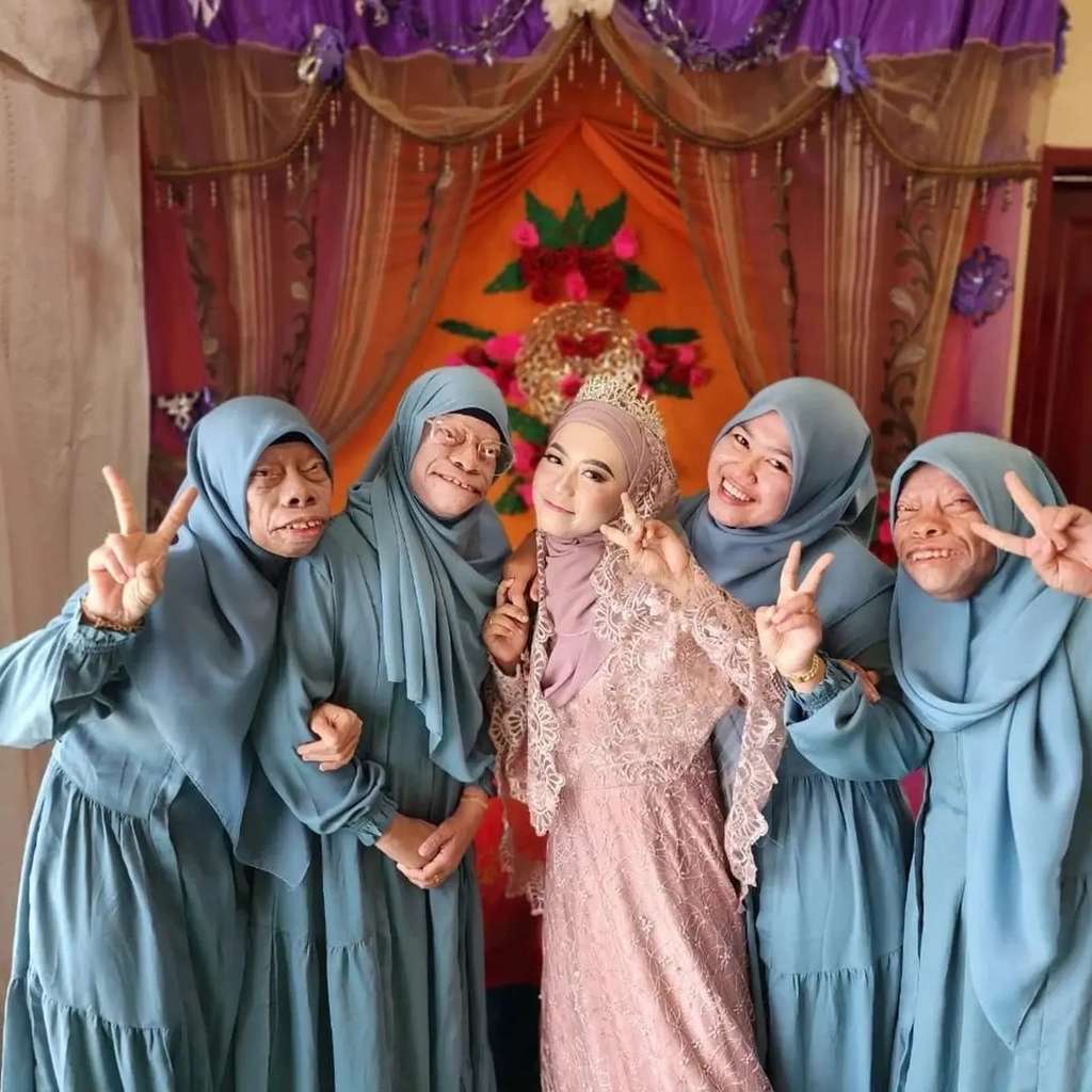 8 Potret Surya Manurung `Pengidap Sindrom Langka` Usai Nikahi Wanita Cantik, Kemesraannya Disorot!