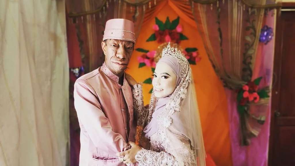 8 Potret Surya Manurung `Pengidap Sindrom Langka` Usai Nikahi Wanita Cantik, Kemesraannya Disorot!