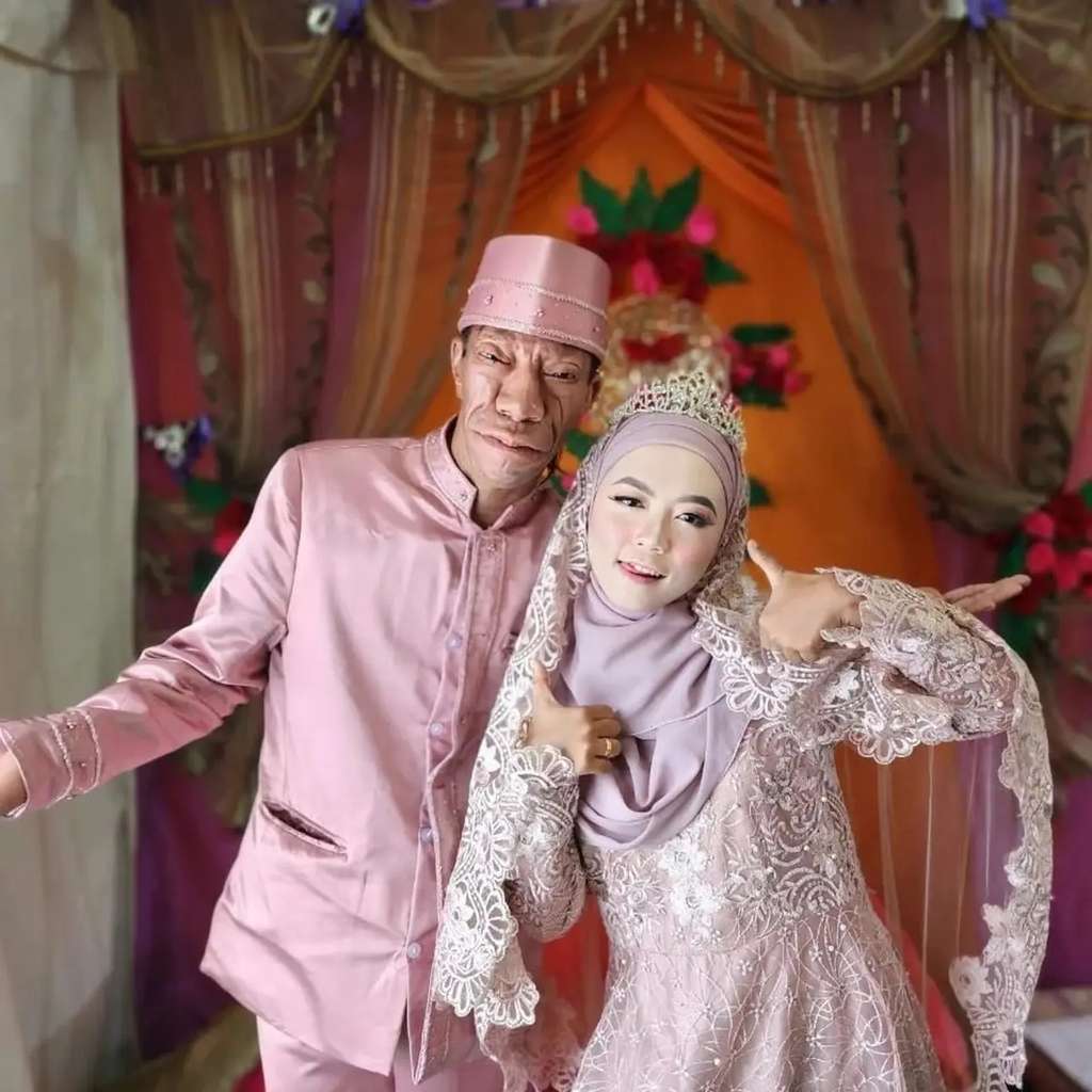 8 Potret Surya Manurung `Pengidap Sindrom Langka` Usai Nikahi Wanita Cantik, Kemesraannya Disorot!